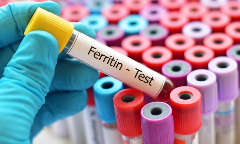 سعر تحليل Serum Ferritin في جميع معامل مصر 2024